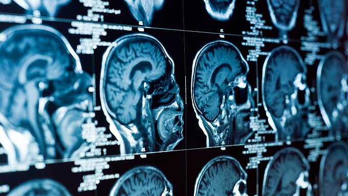 Magnetic Resonance Imaging