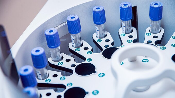 Microfluidics